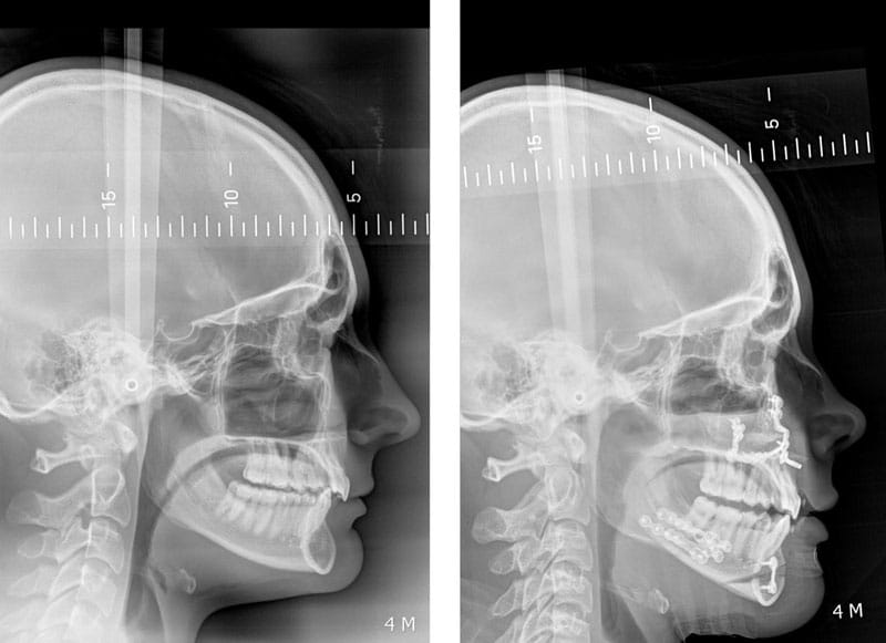 chirurgien maxillo facial paris chirurgie guidée avant après meilleur